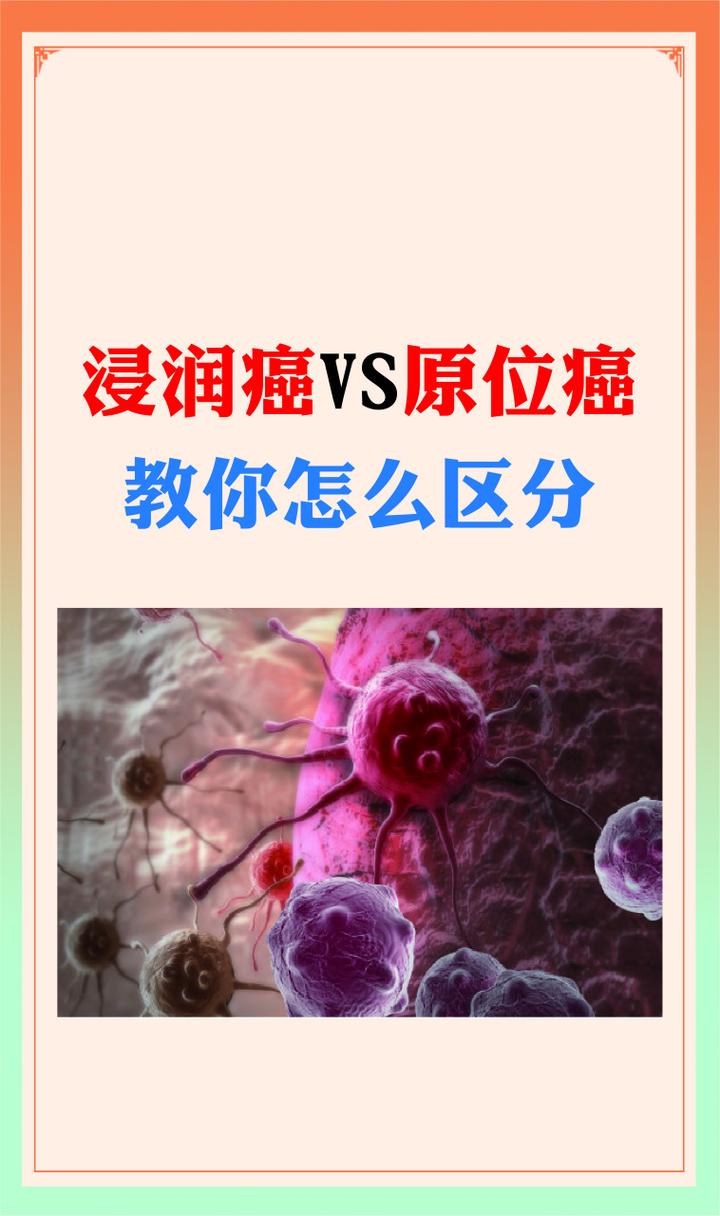 原位癌是什么意思，原位癌是什么意思严重吗