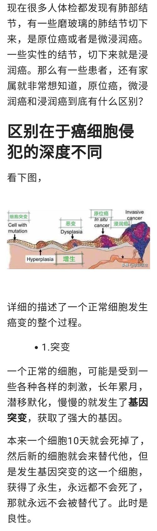 原位癌是什么意思，原位癌是什么意思严重吗